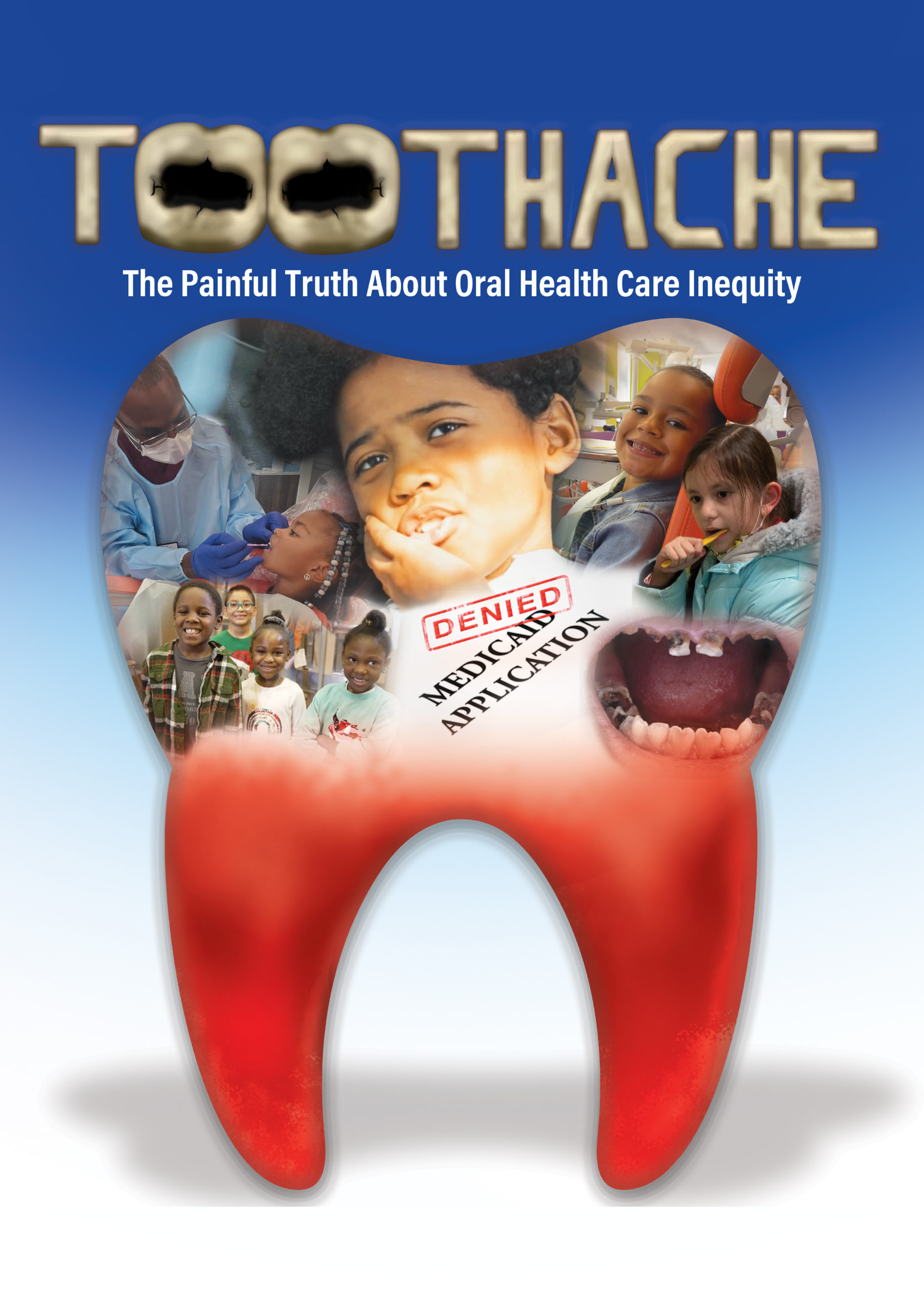 Toothache: The Painful Truth about Oral Health Care Inequity